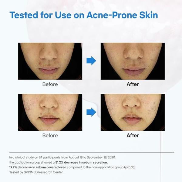 Witch Hazel Hyaluronic Toner Pad (130ml)